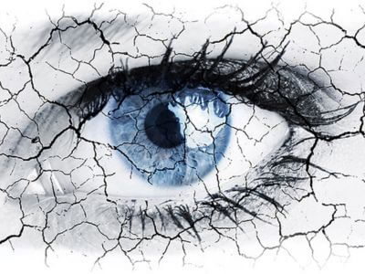 olho seco sindrome especialista diagnostico tratamento exames 400